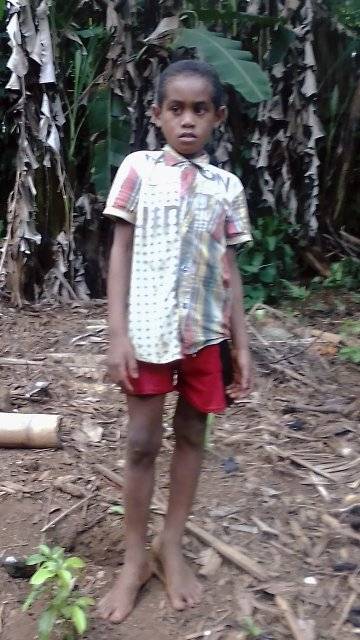 Fabrice - Enfant à parrainer à Madagascar