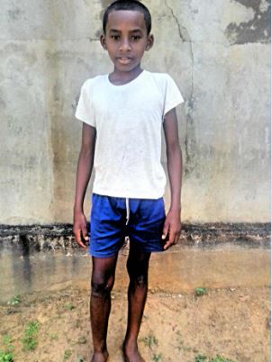 Josio, un jeune garçon malgache pauvre à parrainer